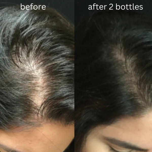 Zeva Harbal Magical Hair Oil (💯Guaranteed Visibal Results)