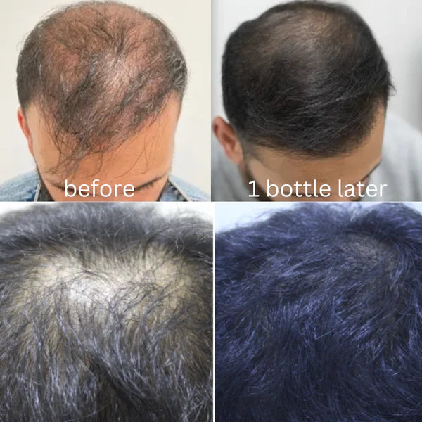 Zeva Harbal Magical Hair Oil (💯Guaranteed Visibal Results)